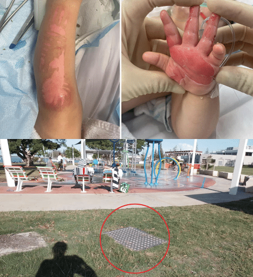 Aussie toddlers bloodcurdling screams after horrendous playground injury